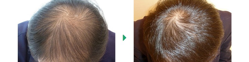 ��AGA�O���[�o���r���[�e�B�[�N���j�b�N���T�C�g